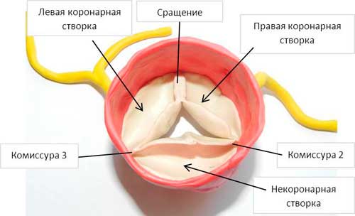 аортальный клапан