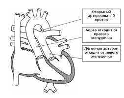 основные артерии сердца
