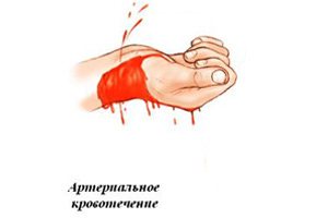 кровотечение из руки