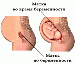 Варикозное расширение матки как выглядит thumbnail