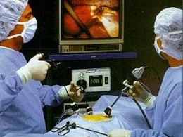 операция на сердце
